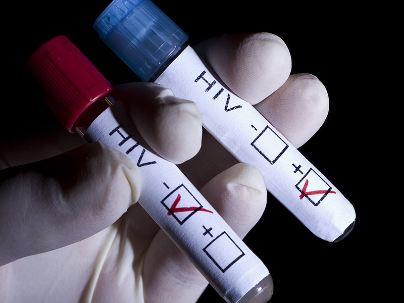 Glasgow in grip of "unusual" HIV outbreak as the number of new cases soar